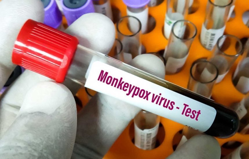 [Ministério da Saúde confirma primeira morte por varíola dos macacos no Brasil]