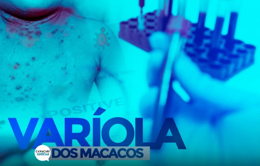 [Secretaria da Saúde confirma mais dois casos de varíola dos macacos em Salvador]